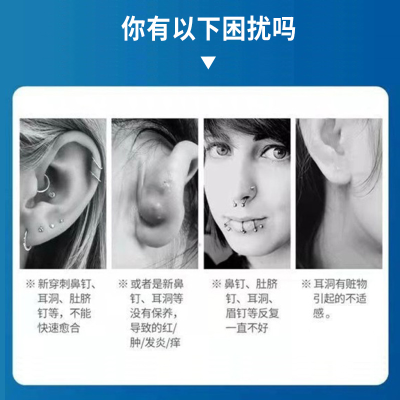新品耳洞增生疙瘩耳洞发炎药膏耳洞护理液疤痕增生凸起去除疙瘩修