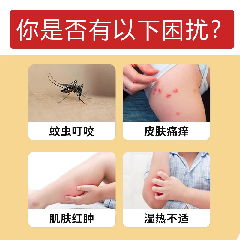 推荐防蚊虫叮咬药膏成人儿童紫草膏植物配方蚊子叮咬止痒日本神器