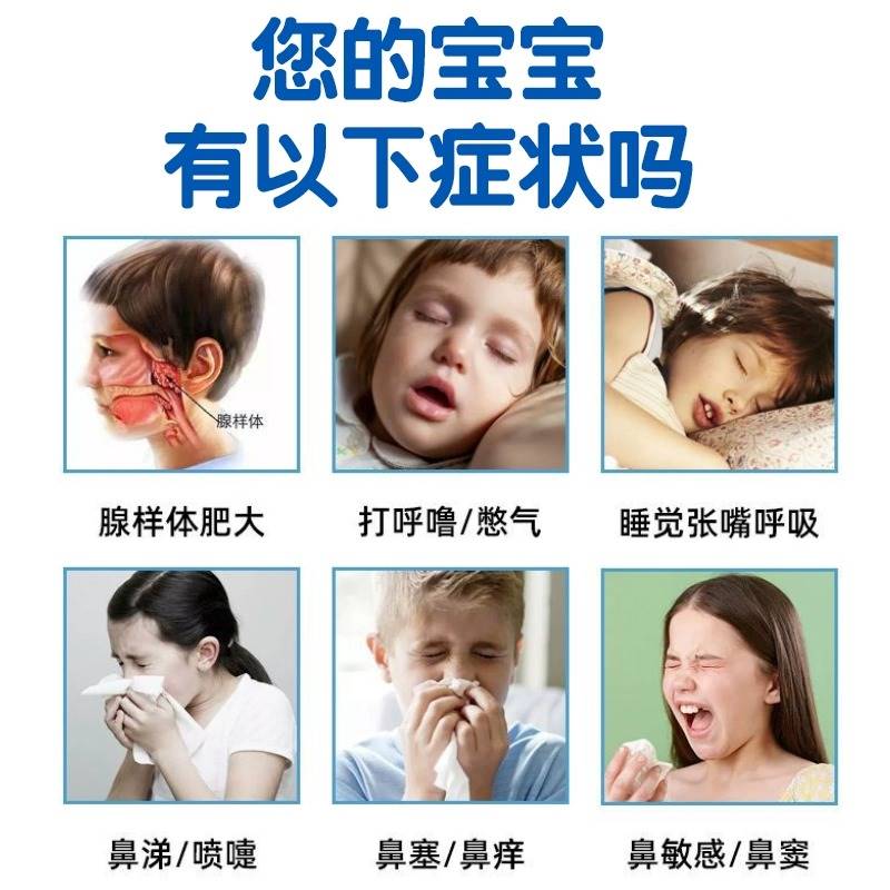 推荐腺样体肥大面容中药贴儿童睡觉张嘴呼吸流涕鼻塞打鼾专用膏矫