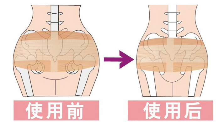 医用骨盆固定带 盆骨矫正带  产后束臀 带钢板 孕妇合盆带