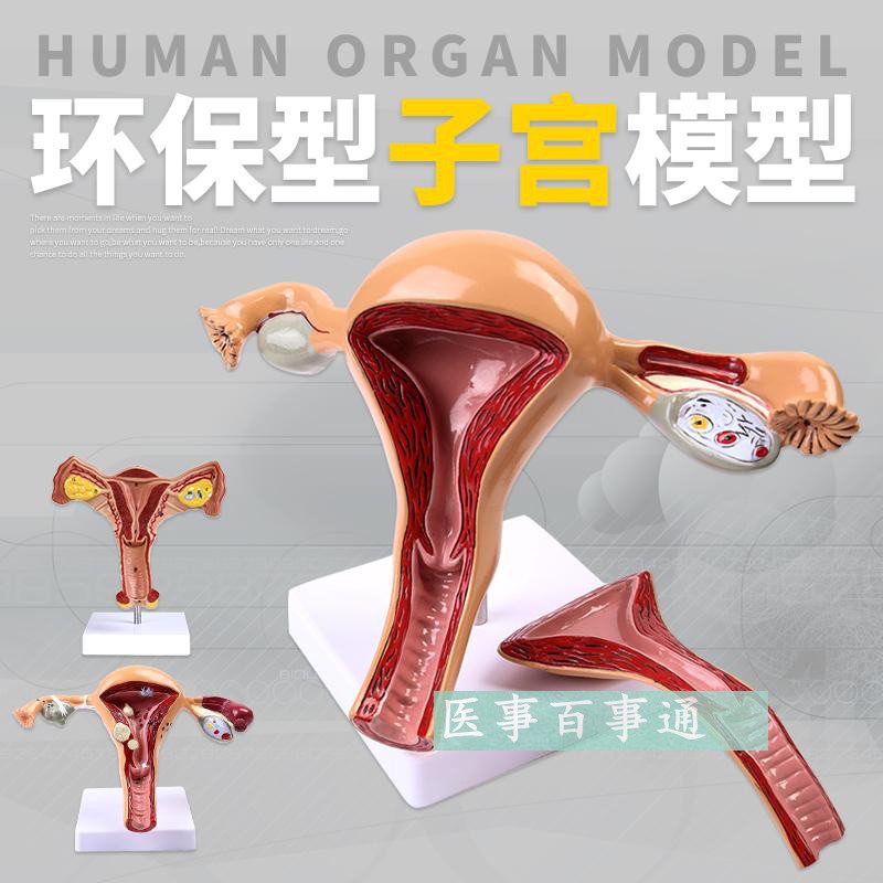 人体模型女性生殖子宫模型阴道卵巢模型教学模具病理变化科学教具